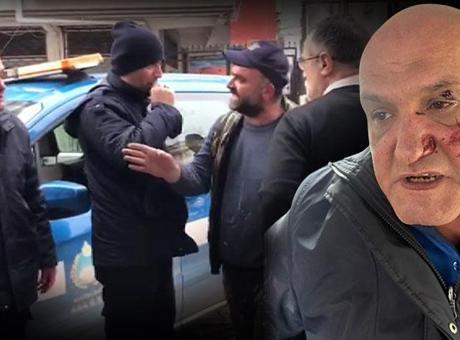 Kaldırıma Park Edilen Araç Üzerine Tartışma: Zabıta Memuru Yaralandı