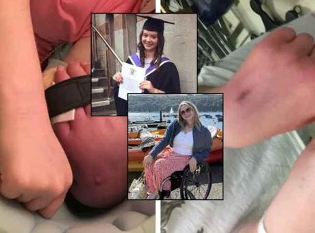 Genç Kadının 'İntihar Hastalığı' ile Savaşım: Sosyal Medya İle Yeniden Doğuş