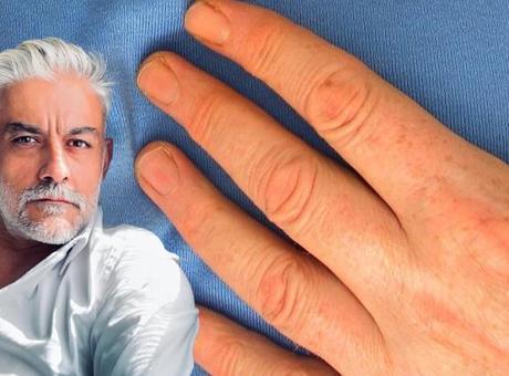 Gençler Kalp Sağlığına Dikkat Etmeli: Ani Ölümler Artıyor