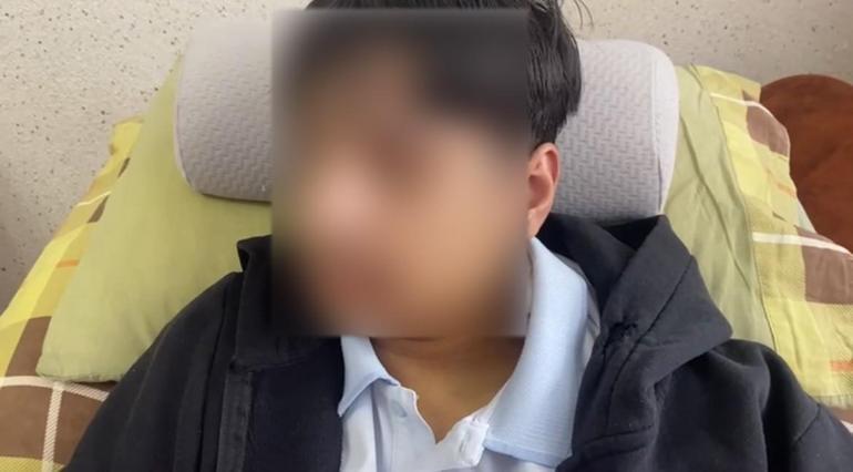 Liseli Öğrencinin Akran Zorbalığı Nedeniyle Çene Kırığı: 1 Yıl Sürebilecek Tedavi Süreci