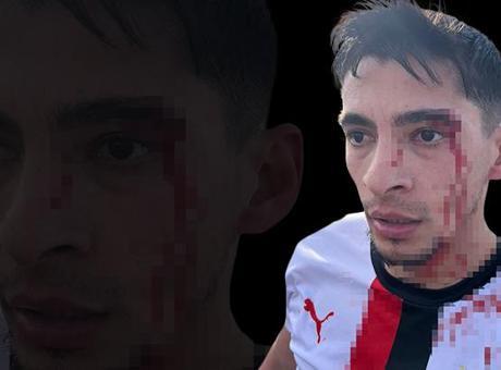 Amatör Futbol Maçında Kargaşa: 3 Futbolcu Hastanelik Oldu