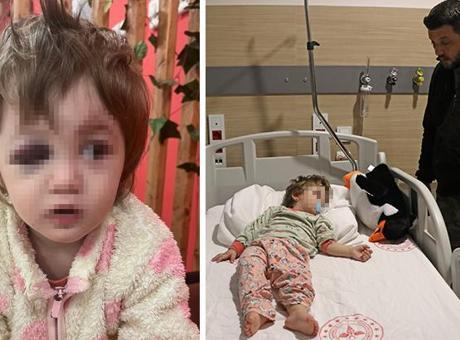 Yalova'da 14 Aylık Kızıyla Saldırıya Uğrayan Baba Açıklamalarda Bulundu