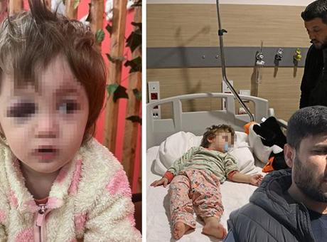 Yalova'da Bebeği Yaralayan Saldırı: Komşu Aile Olayı Anlattı