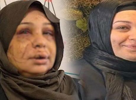 Ankara'da Eşini Yaralayan Polis Memurunun Dava Dosyası Ağır Ceza Mahkemesi'ne Gönderildi