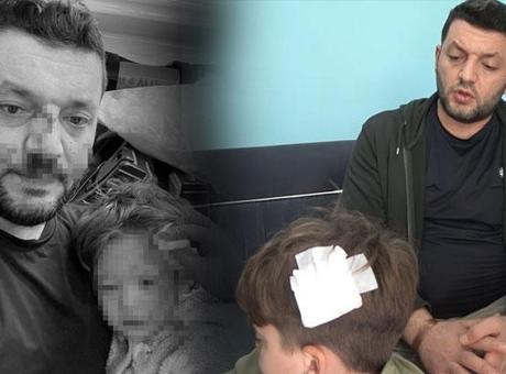 Esenköy'de Aileler Arasındaki Gerilim Had Safhaya Ulaştı: Baca Ailesi Evi Satışa Çıkardı