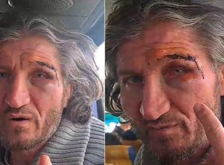İsrail'in Saldırısında Alıkonulan Hüseyin Oral, Şiddet ve Çalınan Parayı Anlattı