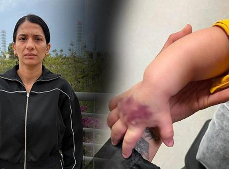 1,5 Yaşındaki Çocuğun Tomografi Süreci Kabusa Döndü: Kolunda Ciddi Hasar Oluştu