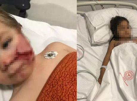 Pitbull Saldırısının Arkasındaki Olayda Mahkeme Karara Vardı: 'Çocuğumu Mahvettiler'