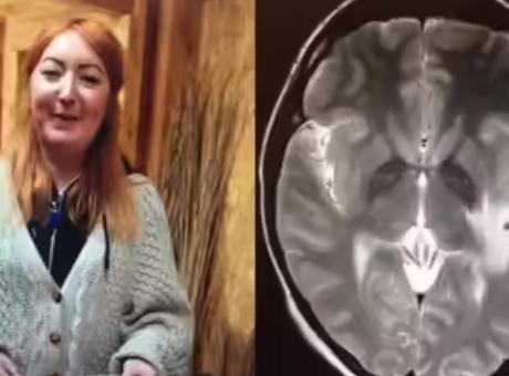Hindistan Seyahati Sonrası Yaşadığı Kabus: Beyninde 38 Parazit Tespit Edildi